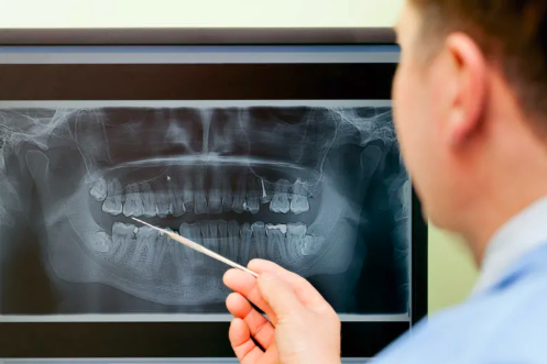 dental x-ray