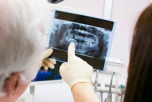 dental x-ray
